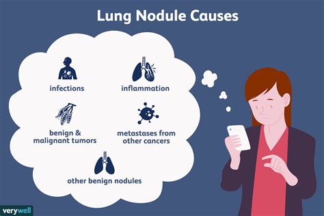 Do Non Cancerous Nodules In The Lung Grow Bigger CancerWalls