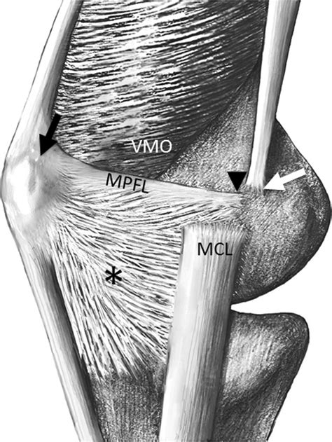 Medial Stabilizing Soft Tissue Structures Of The Knee The Medial
