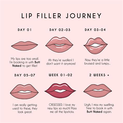 Lip Filler Journey Lip Fillers Facial Aesthetics Cosmetic Injectables