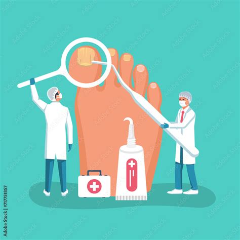 Nail Disease Onychomycosis Concept Fungal Nails Infection Doctors