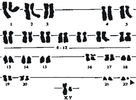 Karyotype Philadelphia Chromosome Download Scientific Diagram