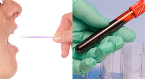 Dna Testing Swabs Vs Blood Samples Ddc Uk Dev