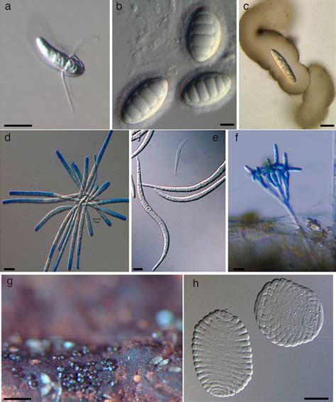 Freshwater Fungi As A Source Of Chemical Diversity A Review Journal