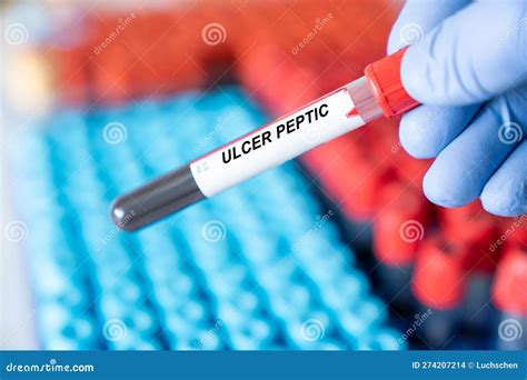 Ulcer Peptic Ulcer Peptic Disease Blood Test In Doctor Hand Stock