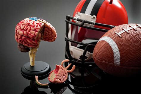 Cte Found In Of Nfl Players Brains Boston University Study Says