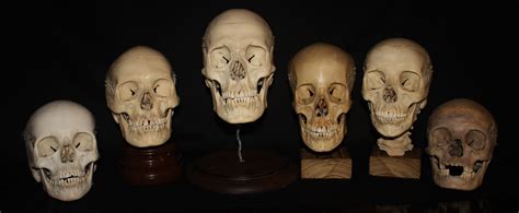 Is Owning A Human Skull Legal Oddarticulations Llc