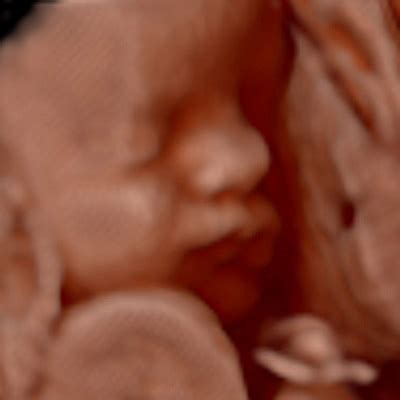 Hd Face Mother Nurture Ultrasound