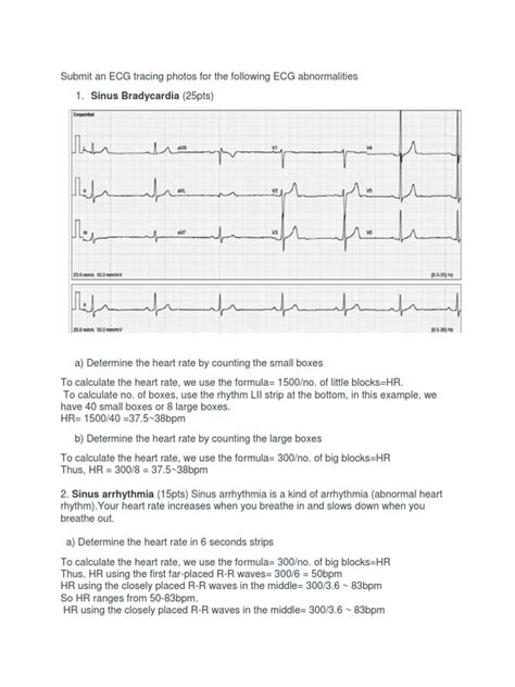 Ecg Interpretation Pdf Electrocardiography Ventricle Heart