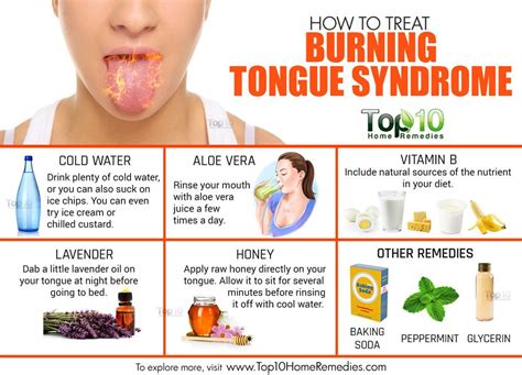 How To Treat Burning Tongue Syndrome Top 10 Home Remedies
