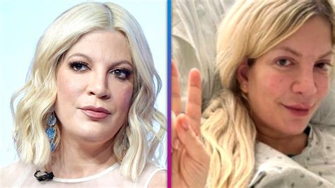 Tori Spelling Reveals She Got An Eye Ulcer After Leaving In Her