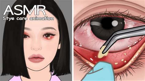 Asmr Animation To Remove Thick Outer And Inner Stye Satisfying Sound