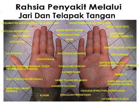 Sesungguhnya beberapa penyakit muncul dengan ditandai. Analisis Penyakit Melalui Tapak Tangan | Download Percuma