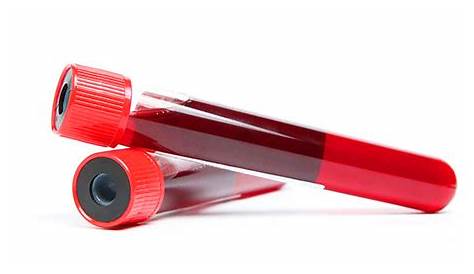 blood tubes in veterinary medicine