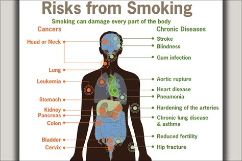 X Gallery Poster Health Risks From Smoking Cdc Diagram Cancer