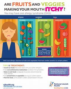 How To Help An Itchy Throat Sellsense23