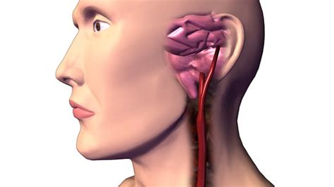 He or she will make a cut (incision) on the side of the neck over the affected carotid artery. Steer Clear of These 9 Artery and Vein Diseases | Everyday ...