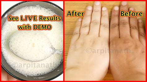 Skin Whitening Home Remedies With Baking Soda Your Magazine Lite