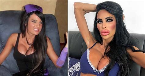‘plastic Barbie’ Junkie Spends £55 000 On Surgery Admits She’s ‘addicted’