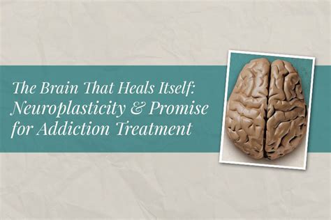 The Brain That Heals Itself Neuroplasticity And Promise For Addiction Treatment Alta Mira