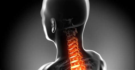 3 Simple Tips For Alleviating Your Chronic Neck Pain