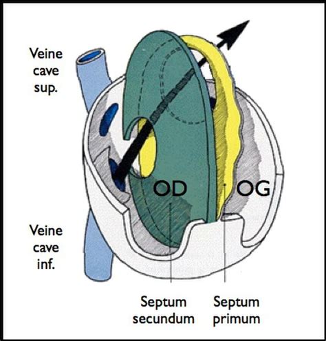 Foramen Ovale Perméable Définition Et Explications