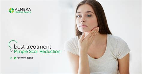 What Is The Best Treatment For Pimple Scar Reduction Almeka Medical