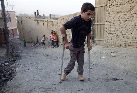 13 Photos De Médecine Issues Du Passé Sur Le Traitement De La Polio