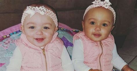 Chromosome Twins Rare Illinois Sisters Will Make Your Heart Melt