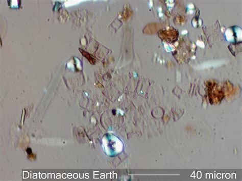 Diatomaceous Earth Under The Microscope
