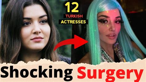 Turkish Actresses Shocking Transformation Before And After Surgery Hande Ercel Youtube