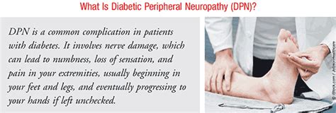 Diabetic Peripheral Neuropathy How Can We Help Our Patients