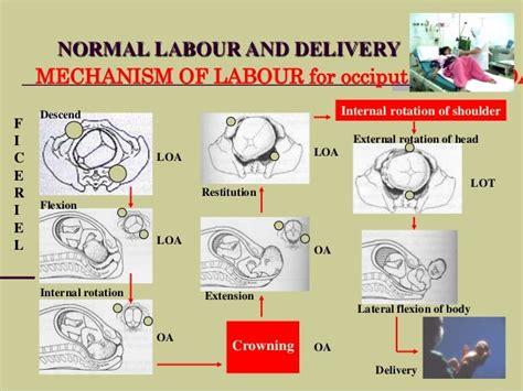 Normal Labour And Delivery