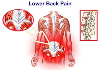 If you have existing back pain or problems, consult your doctor for advice as some of these products may not be recommended if you have an existing problem. Konl: Lower back muscle pain relief right side left side ...