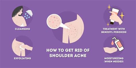 How To Get Rid Of Shoulder Acne Skincare Hero