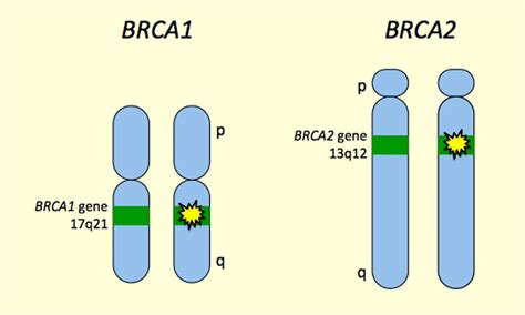 Potential Interactions Between Brca1 Or Brca2 Gene Defects And Des Exposure Diethylstilbestrol Des
