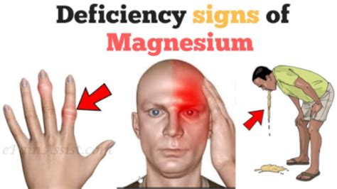 11 warning signs of magnesium deficiency that you should not ignore