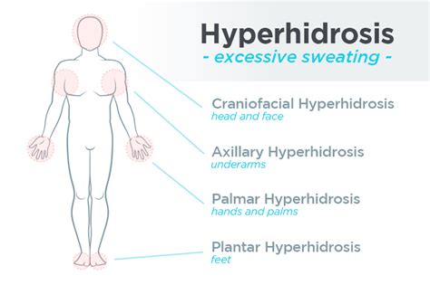 Focal Hyperhidrosis Symptoms Treatments And More Sweatblock