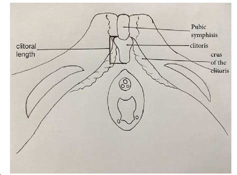 Schematic Diagram Of Clitoris And Surrounding Structures Showing The Download Scientific