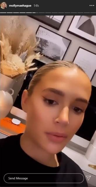Molly Mae Hague Reveals Her Natural Lips Are ‘stretched By Fillers After They Were Dissolved