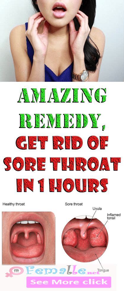 Amazing Remedy Get Rid Of Sore Throat In 1 Hours Healthy Data World