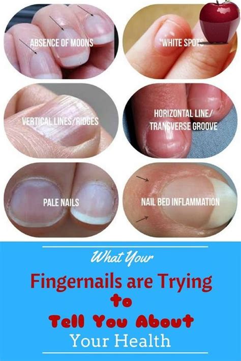 6 Signs Your Fingernails Are Telling You Something About Your Health