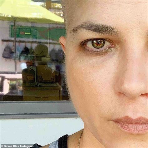 Selma Blair Shows Off Her Substantial Peach Fuzz As She Continues Ms