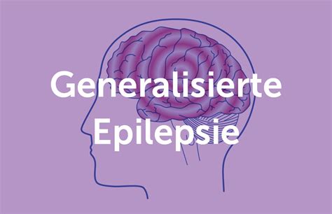 Kombinierte Generalisierte Und Fokale Epilepsie Ucbcares