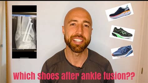 Ankle Fusion What Trainers To Wear After Ankle Fusion Surgery Youtube