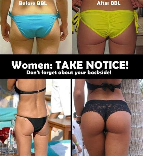 Brazil Butt Lift Results Top Pic Why Its Important To Build Muscle Bottom Pic Fitspiration