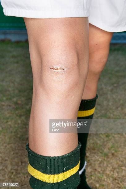 Skinned Knee Photos Et Images De Collection Getty Images