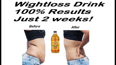 Apple Cider Vinegar Weightloss Drink 100 Results In Just 2 Weeks