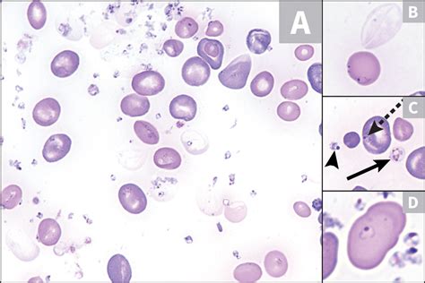 Babesiosis Clinicians Brief