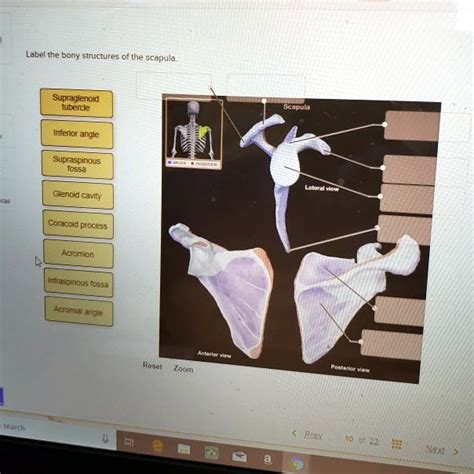 Solved Label The Bony Structures Of The Scapula Supraglenoid Tubercle