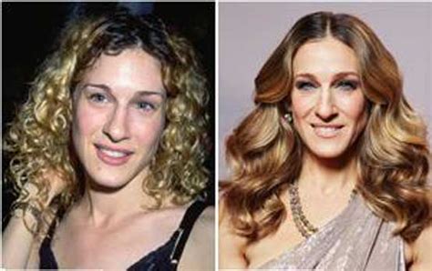 Sarah Jessica Parker Plastic Surgery Nose Job Botox After And Before